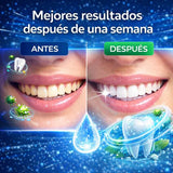 DENTAL HIDROXIAPATITA -Protector Bucal, Gotas de Reparación de Caries,Reparación de Esmalte, Salud de las encías